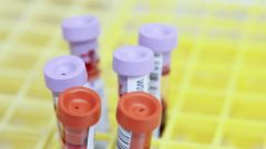 Аналіз на ВІЛ: як перевірити свій статус?